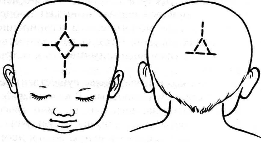 Родничку 1 3 на 1 3. Измерение большого родничка алгоритм. Измерение большого родничка у новорожденного алгоритм. Измерение размеров большого родничка грудного ребенка. Техника измерения размеров большого родничка алгоритм.