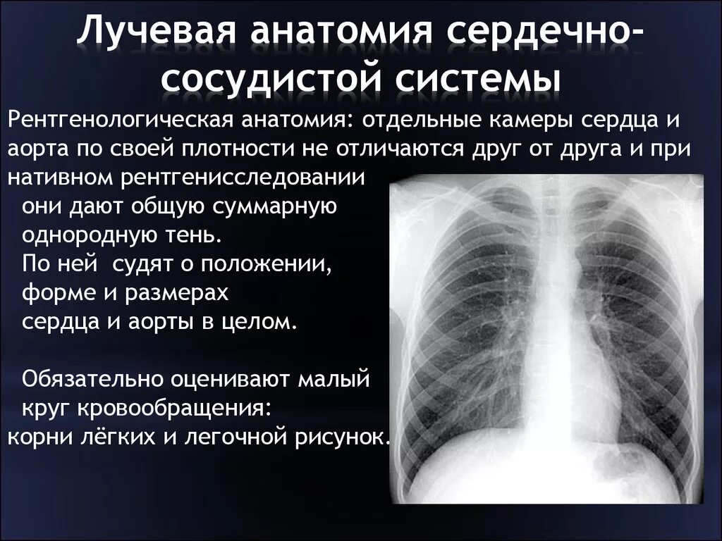 Лучевые заболевания легких. Лучевая анатомия сердца. Рентгенодиагностика сердца. Лучевая анатомия сердца и крупных сосудов. Лучевая диагностика сердца.