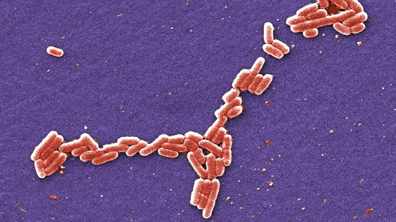 Escherichia coli в микроскопе. Энтеротоксигенная кишечная палочка. Резистентность кишечной палочки. Вибрионы под микроскопом.