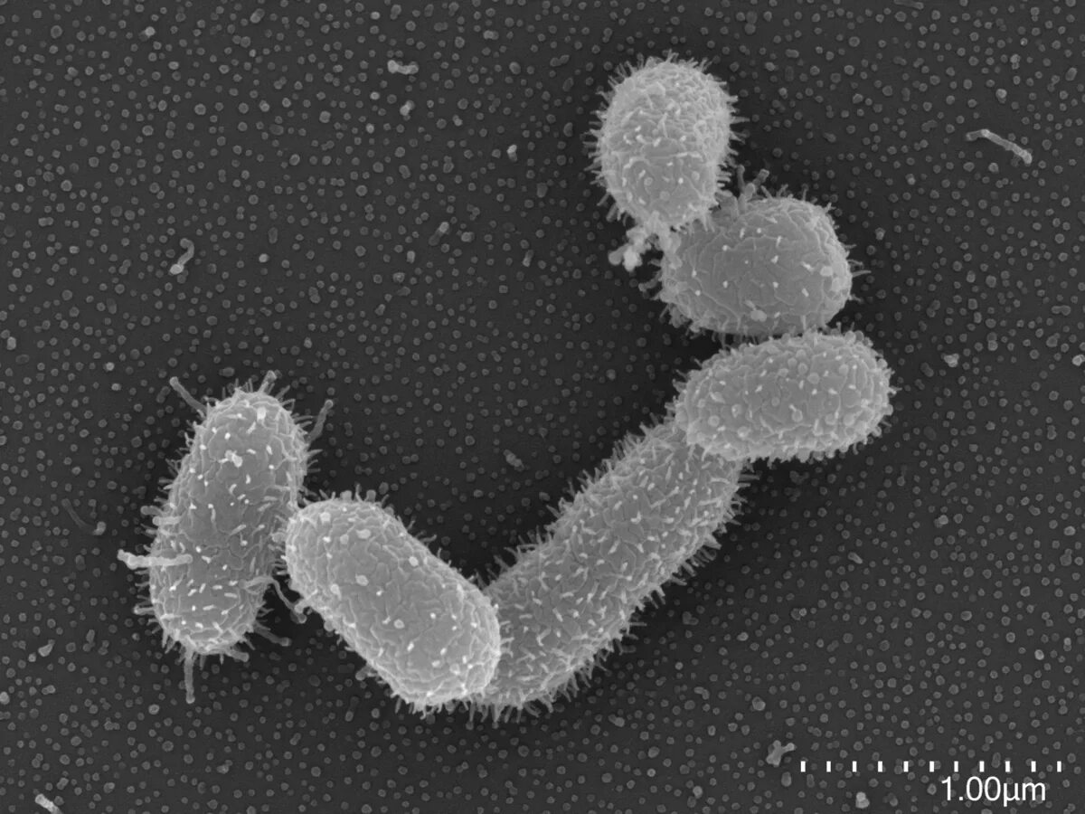 Bacteroides spp что это. Bacteroides fragilis микробиология. bacteroides fragilis возбудитель. бактероиды микробиология. возбудитель бактероиды микробиология.