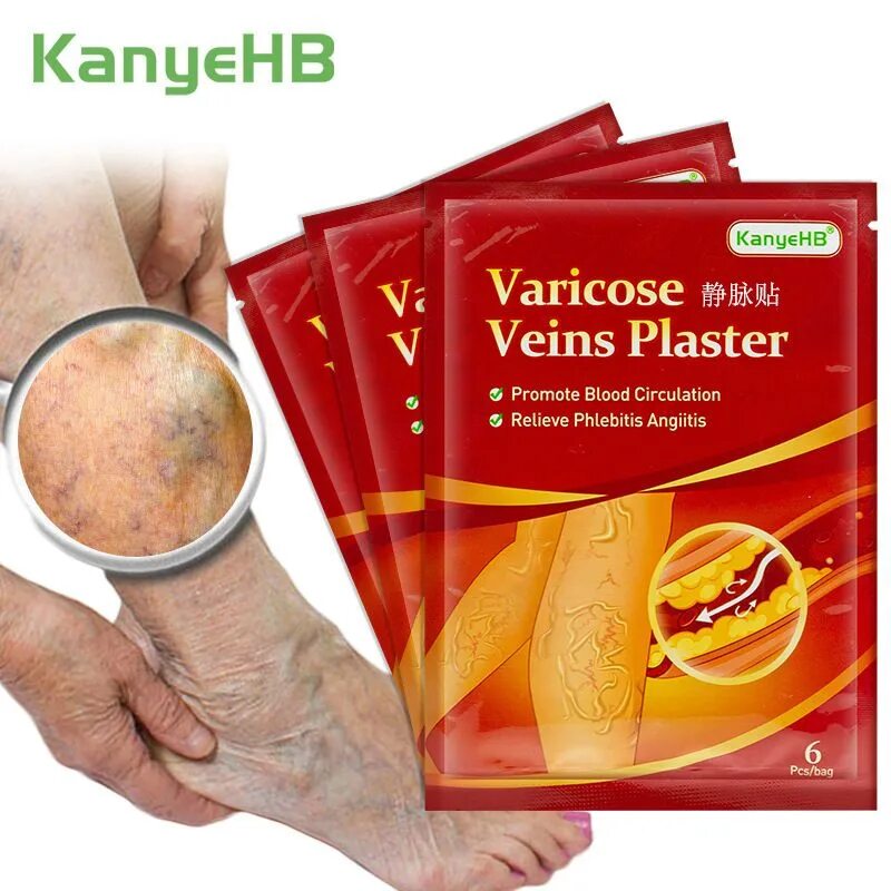 Травы от варикоза. Varicose veins patch инструкция по применению. Пластырь для вен. Повязка от варикоза. Пластырь для вен.