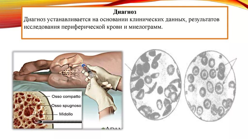 На основании клинических данных. Наследственные гипо- и апластические анемии презентация. Н 13 диагноз.