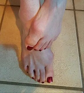 Victoria feet