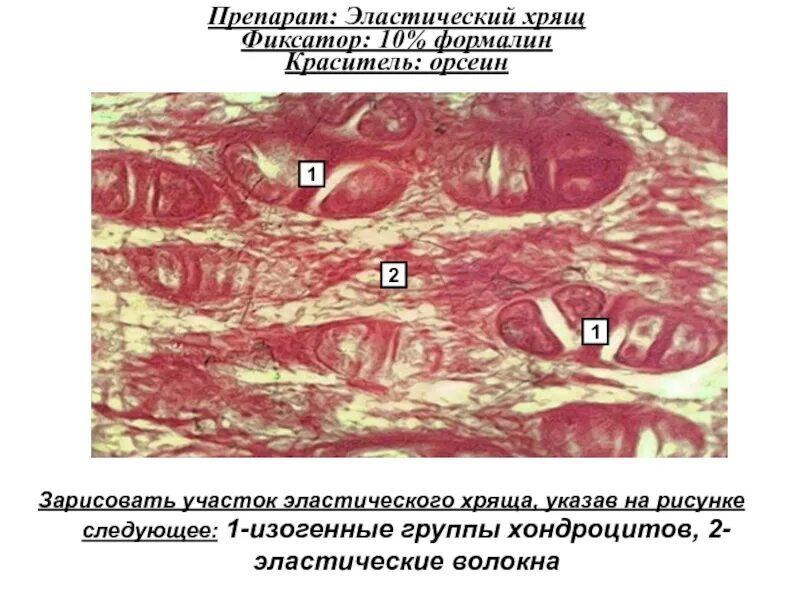 Изогенные группы. Эластический хрящ препарат орсеин. Эластический хрящ гистология препарат. Эластическая хрящевая ткань гистология орсеин. Участок эластического хряща.