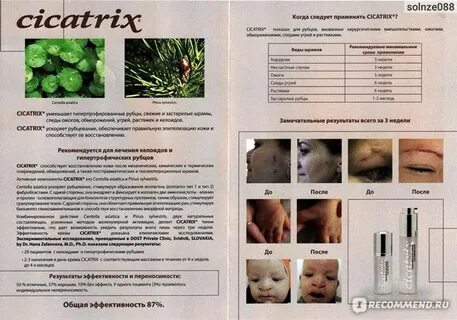 Печать марики от шрамов