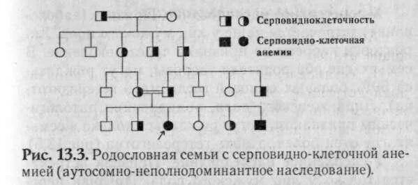 Серповидноклеточная анемия рецессивный. Тип наследования серповидно-клеточной анемии. Схема наследования серповидноклеточной анемии. Серповидноклеточная анемия Тип наследования родословная. Аутосомно-доминантное наследование родословная.