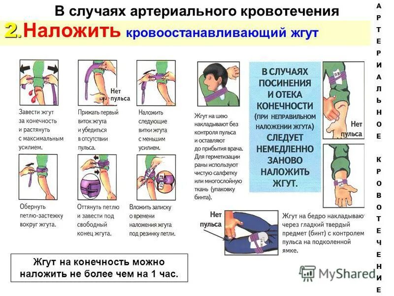 В случае артериального кровотечения необходимо ответ тест. Жгут при артериальном кровотечении накладывается. в случаях артериального кровотечения. жгут на конечности можно накладывать не более чем на. когда следует немедленно наложить кровоостанавливающий жгут.
