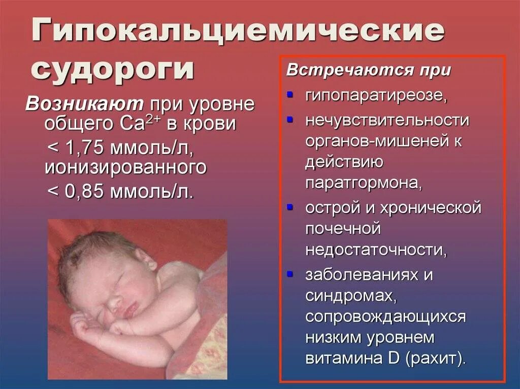 Синдром судорог. Судороги у новорожденных детей. гипокальциемические судороги. причины судорожного синдрома у детей. клинические проявления судорожного синдрома у детей.