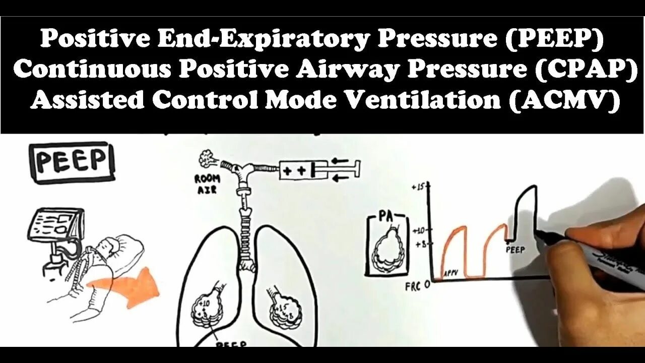 Ending position