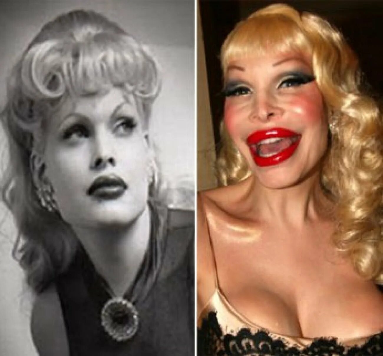 Ужасная операция. Amanda Lepore в молодости.