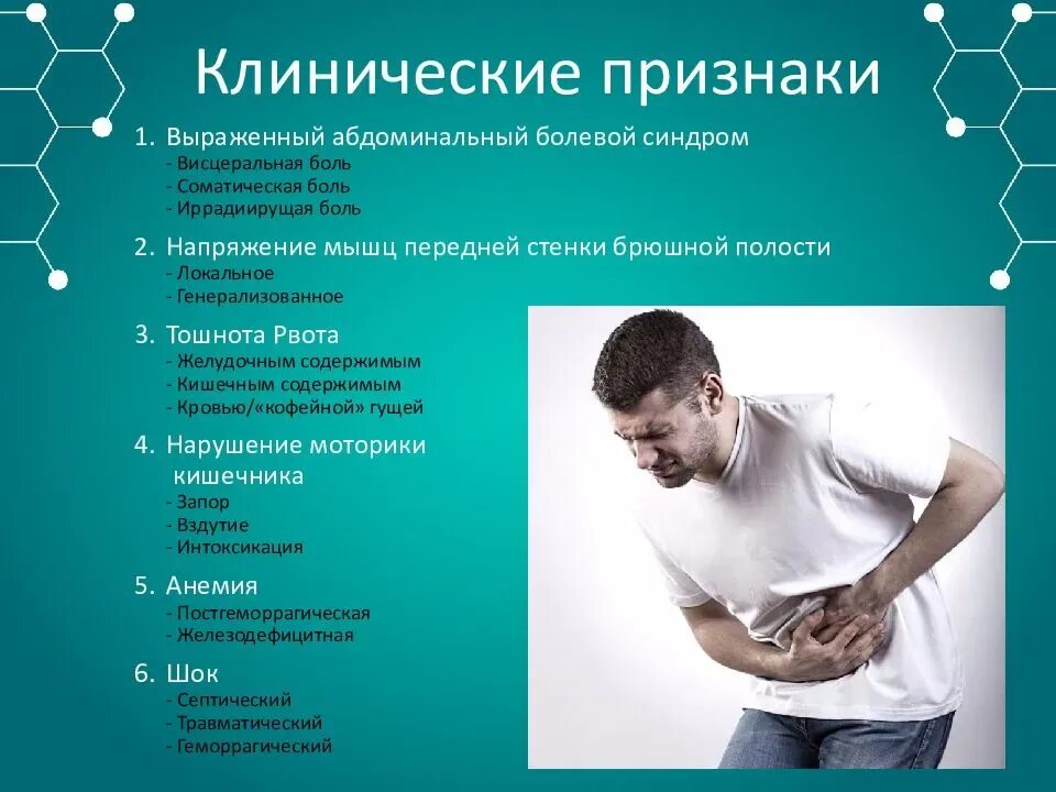 Боли какое число. Абдоминальные симптомы. симптомы абдоминальной боли. болевой синдром симптомы. абдоминальный болевой синдром.