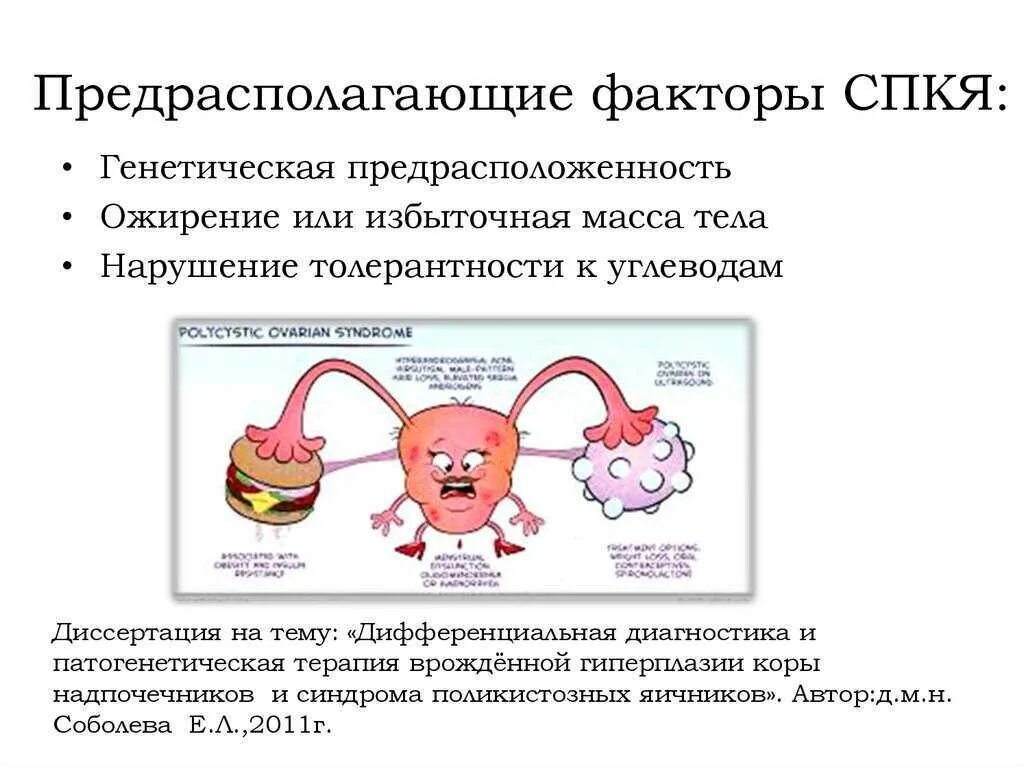 Поликистозные яичники лечение. Поликистоз яичников факторы риска. Клинические рекомендации поликистозных яичников. Синдром поликистозных яичников факторы риска. Синдром поликистозных яичников (СПКЯ).