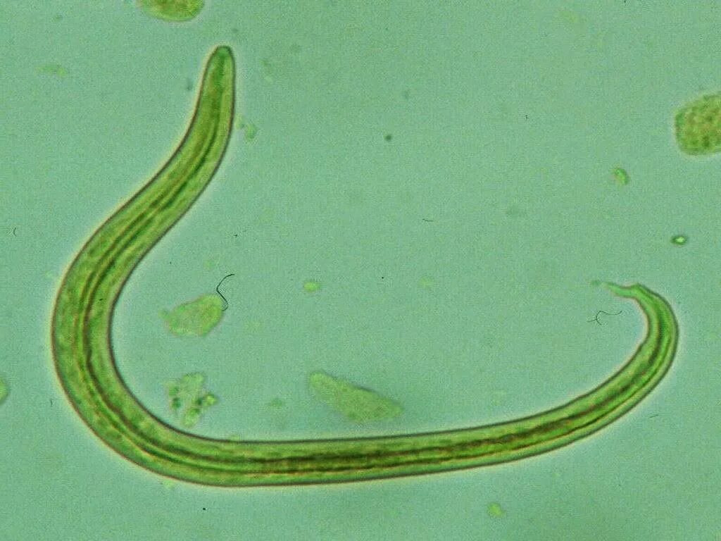 Нематоды диктиокаулез. Цикл развития телязий крс. Глисты крс. Диктиокаулез жвачных яйца. Dictyocaulus viviparus.