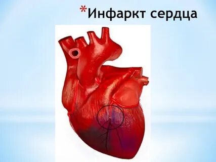 Сердце человека стоит