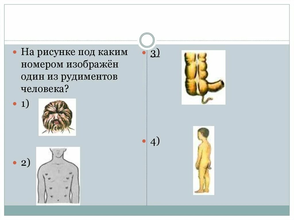 Под каким номером на рисунке изображён рудимент человека?. Какие рудименты человека изображены на рисунке. На рисунке под каким номером изображён один из атавизмов человека?.