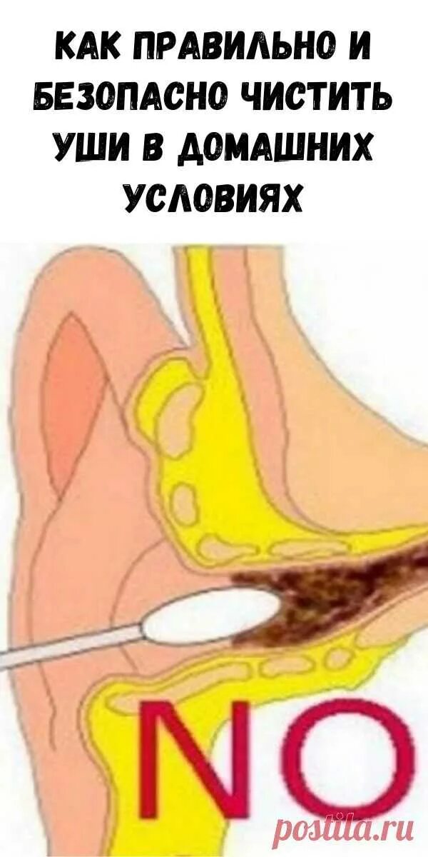 Как быстро почистить ухо. Как правильно чистить уши. Kak pravelno chistit Ushy. Как правильно чистить уши человеку. Чистка ушей в домашних условиях.