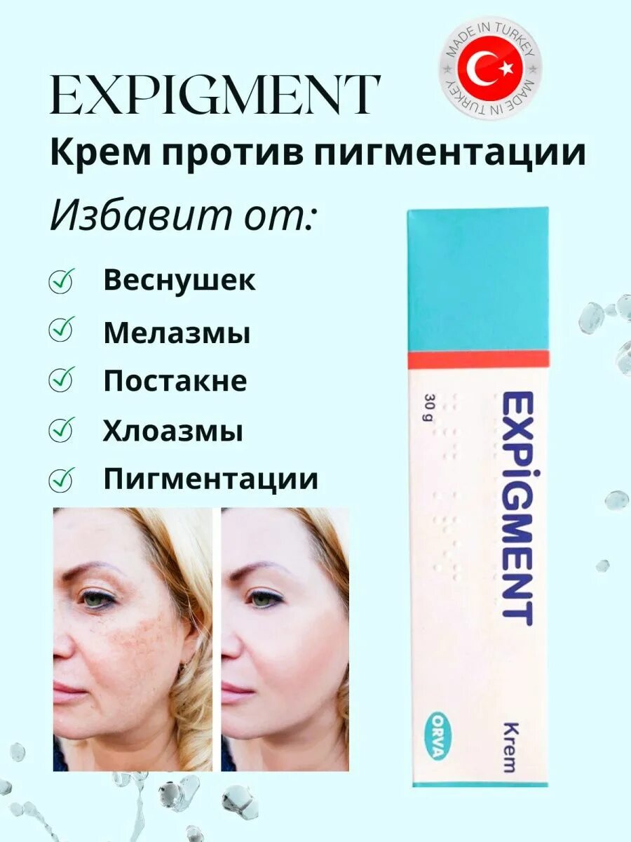 Крем expigment 4 отзывы. Турецкий отбеливающий крем expigment. Expigment 4. Отбеливающий крем expigment 4.