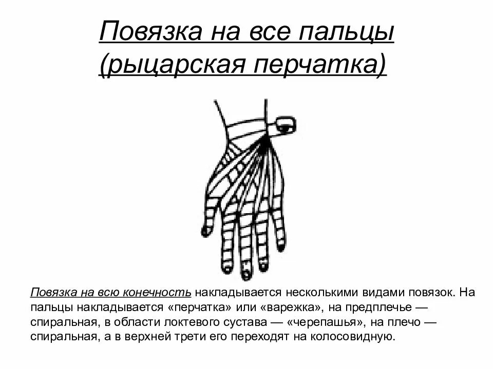 Рыцарская перчатка алгоритм. 15. Наложение повязки «Рыцарская перчатка».. Бинтование Рыцарская перчатка. Рыцарская перчатка десмургия. Повязка Рыцарская перчатка показания.