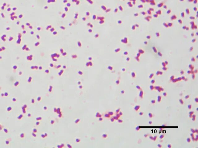 Выявление бактерий рода salmonella. Salmonella spp, сальмонелла.. морфология сальмонелл микробиология. salmonella typhimurium микроскопия. salmonella typhimurium морфология.