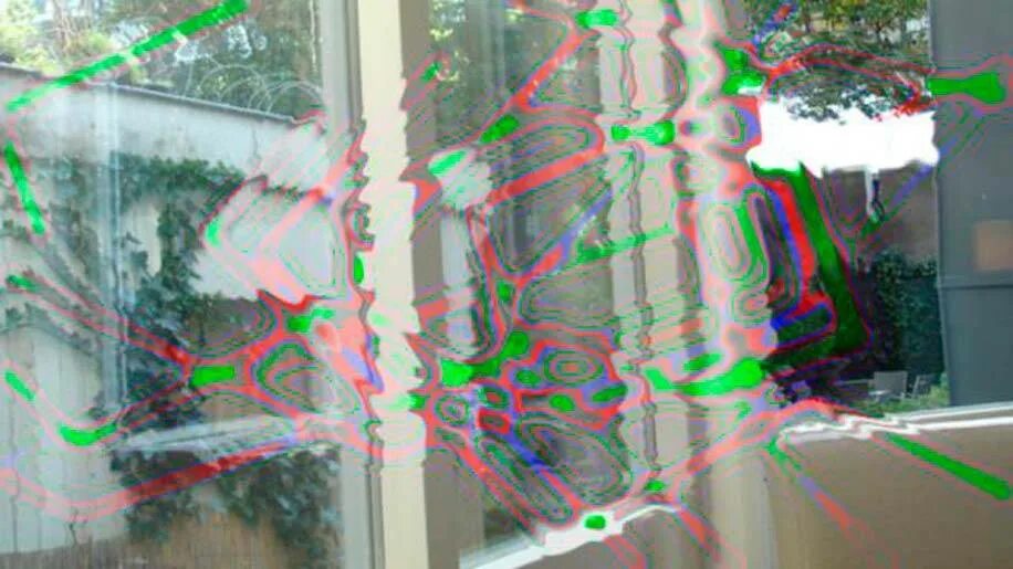 Вспышки молнии перед глазами. Мерцательная зрительная скотома. Деструкция стекловидного тела черные точки. Фотопсии в глазах. Зрительная скотома мерцающий зигзаг.