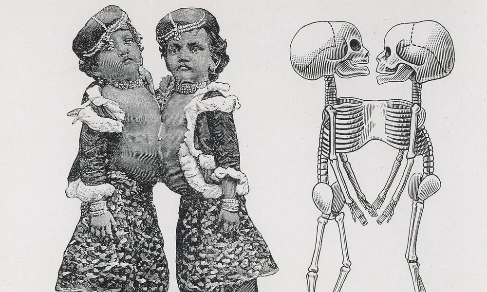 старая статуя. типы сращения сиамских близнецов. памятник любви. сестры эбигейл и британи хенсел. Life drawing academy.