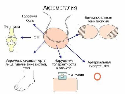 Увеличение кистей и стоп