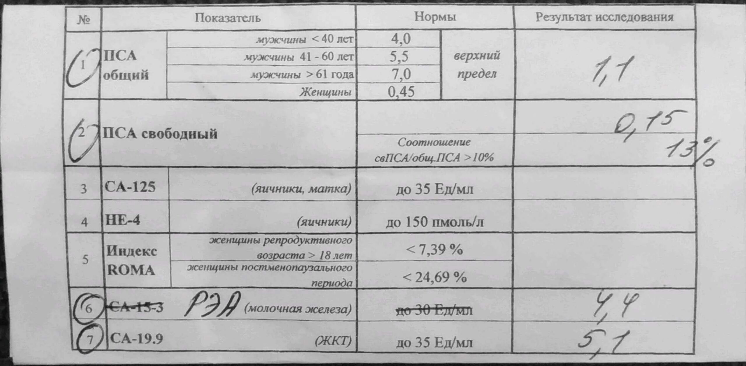 Сама 19 9. Са125 и РЭА. Анализы онкомаркеров. Анализ крови онкомаркер. Результат анализа онкомаркер.