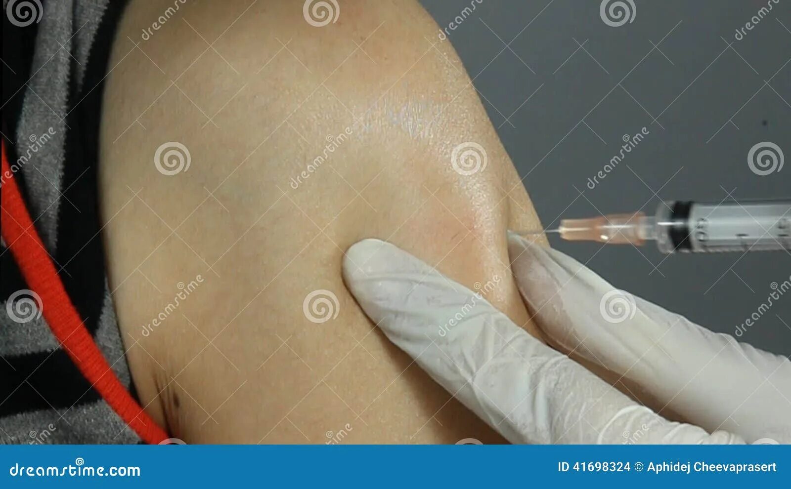 Укол подкожно. Инъекция в дельтовидную мышцу. Уколы себе в плечо. Подкожная инъекция в плечо. Внутрисуставные инъекции.