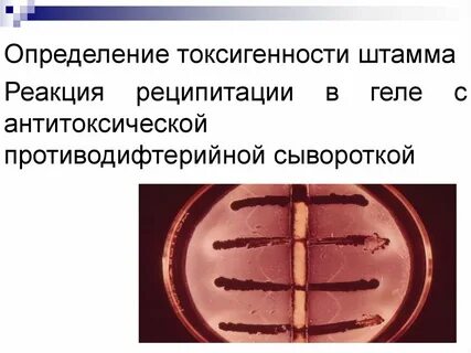 Определение токсигенности дифтерии