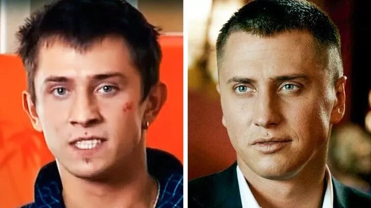 Прилучный до и после операции. Прилучный до и после операции. Прилучный до и после операции. Прилучный до и после операции. Прилучный до и после операции.