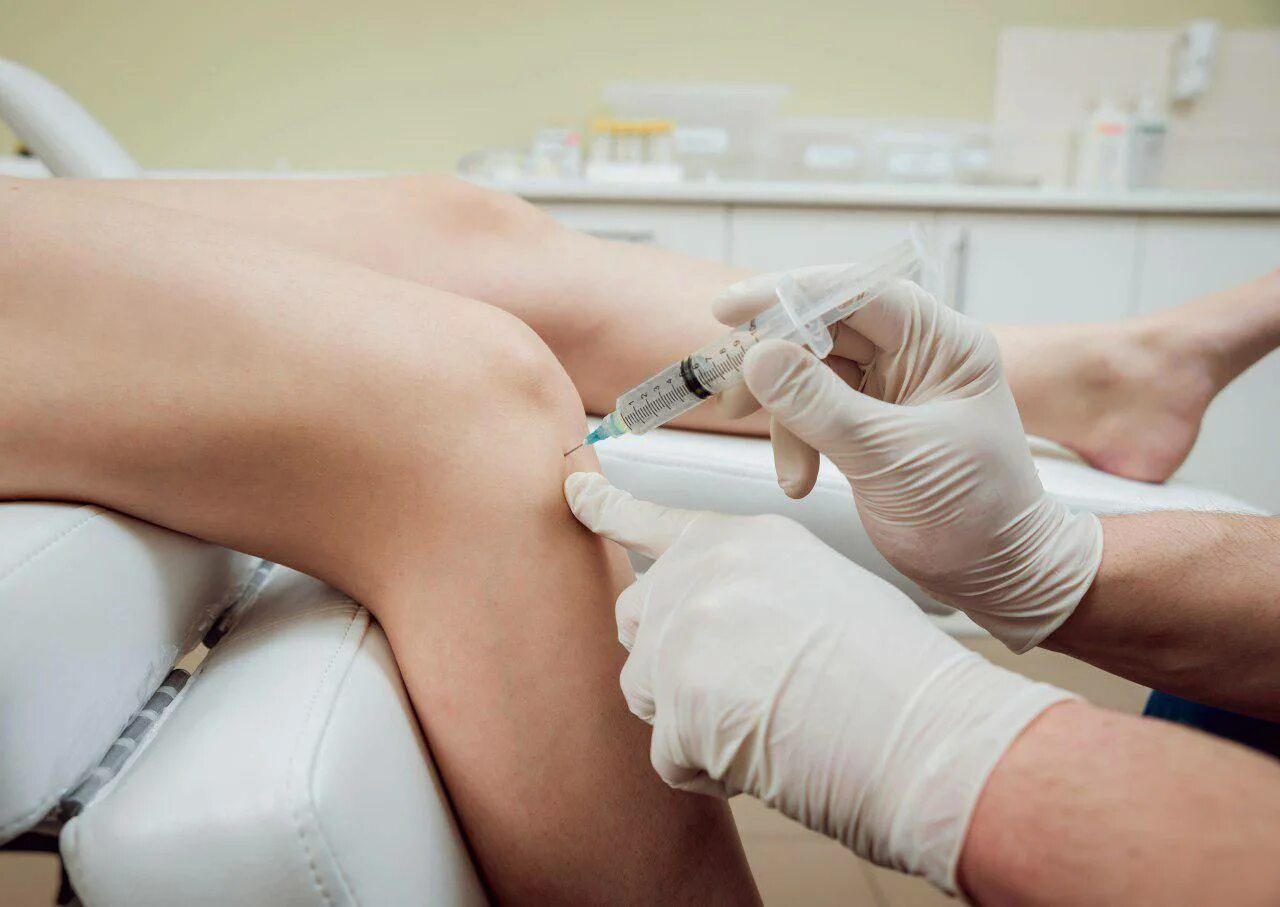 Плазмолифтинг суставов противопоказания. Prp-терапия (platelet rich plasma). плазмотерапия сустав prp. плазма терапия коленного сустава. плазмолифтинг prp терапия коленного сустава.