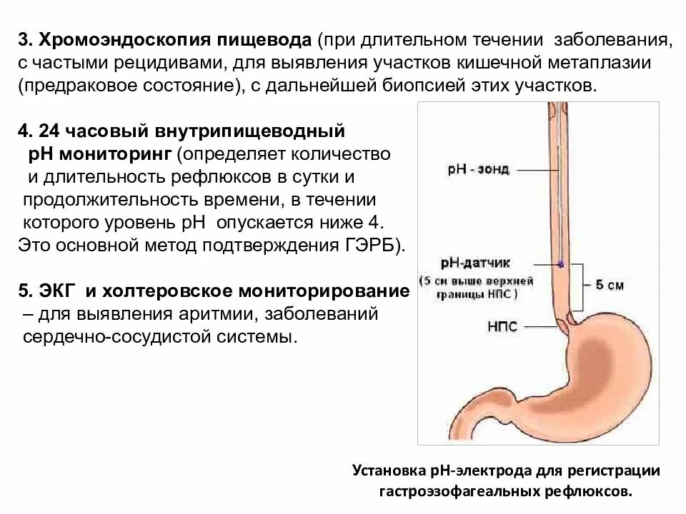 Можно пищевод. Гастро-эзофагальный рефлюкс. Гастроэзофагеальная рефлюксная болезнь (ГЭРБ). Факторы ГЭРБ. Гастроэзофагеальный (желудочно-пищеводный) рефлюкс.