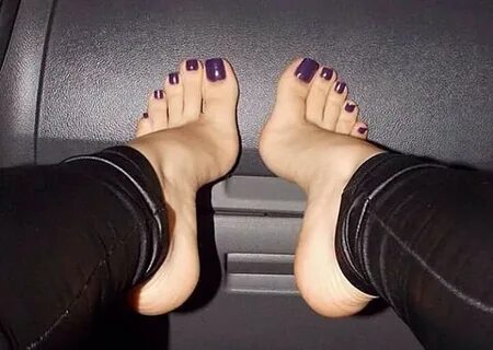 High arched feet