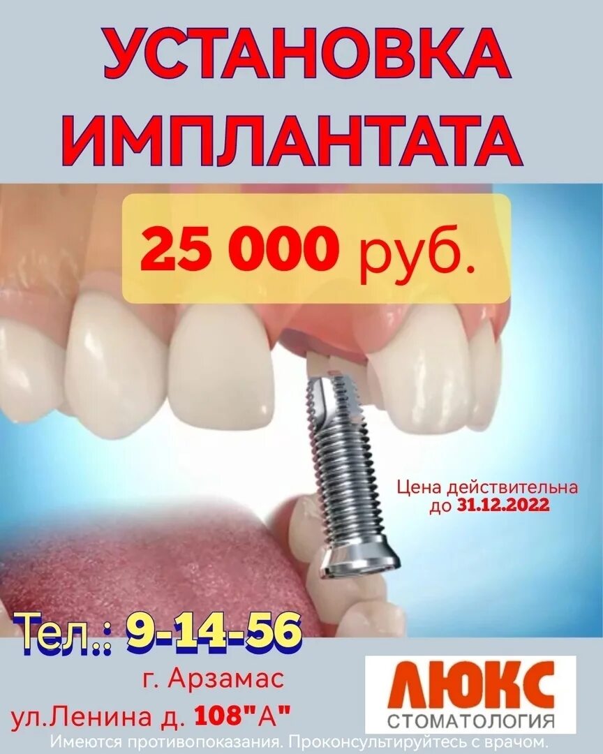 Акции арзамас. Стоматология люкс арзамас. акции в стоматологии. имплант акция. стоматология 62 акции на имплант.