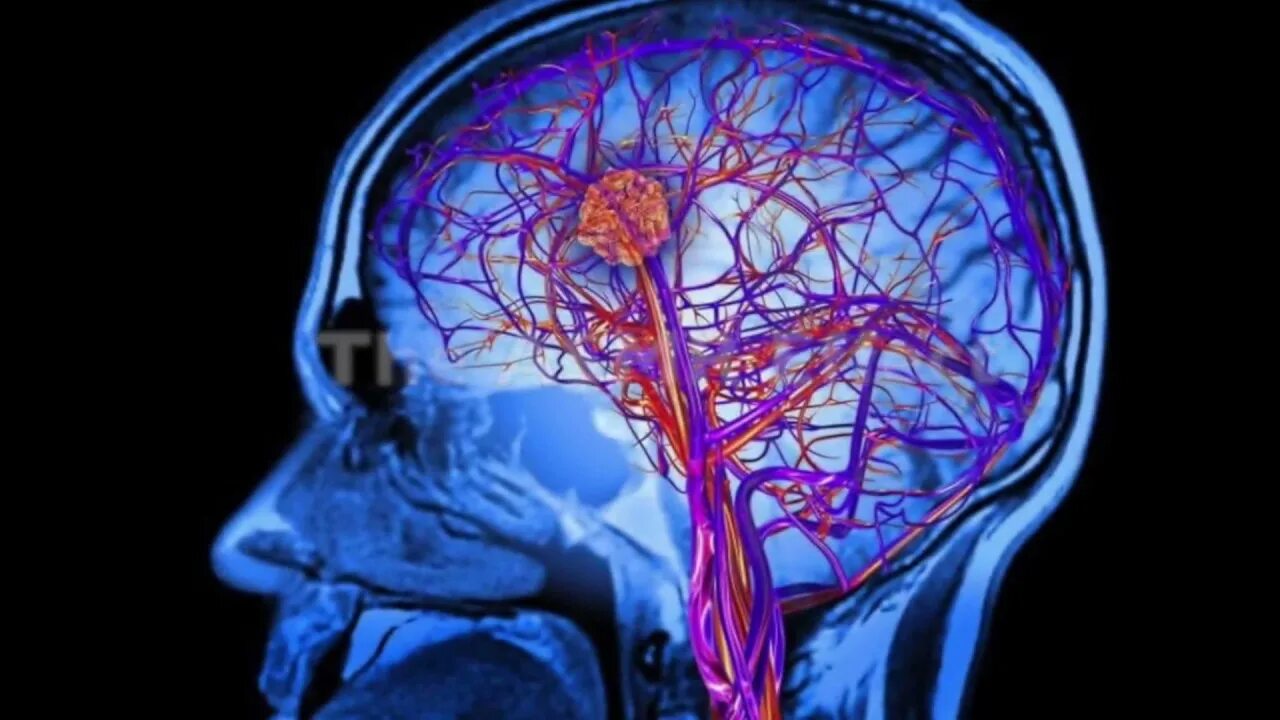 Венография головного мозга. Головной мозг с сосудами артерии и вены. Ангиография головного мозга. Мрт головного мозга и сосудов. Артерии головного мозга на мрт.