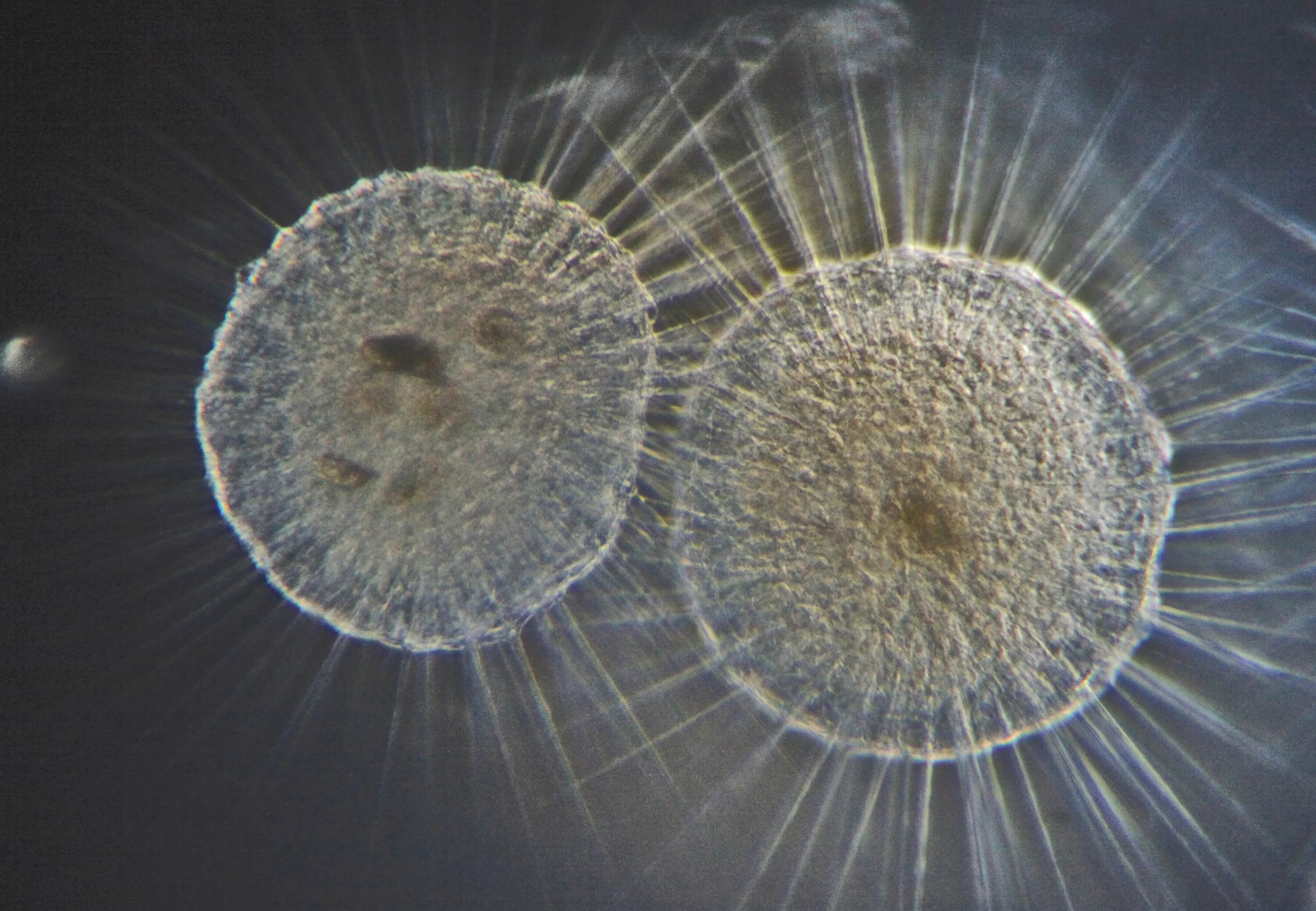 Clathrulina elegans. Протисты солнечники. Протисты солнечники. Класс солнечники (heliozoa). Солнечник одноклеточное.