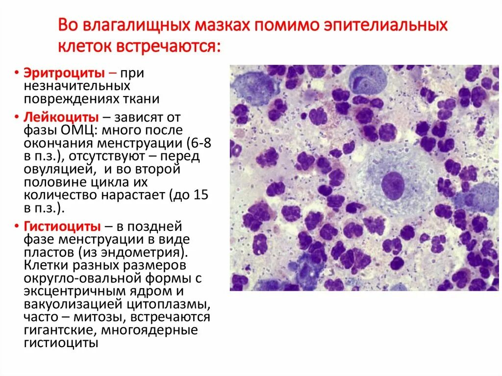 Дисплазия эпителия гистология. Цитологические исследования мазка гинекология. Цитологическое исследование влагалищных мазков. Цилиндрический эпителий цитология. Эпителий клетки цилиндрического эпителия слизь