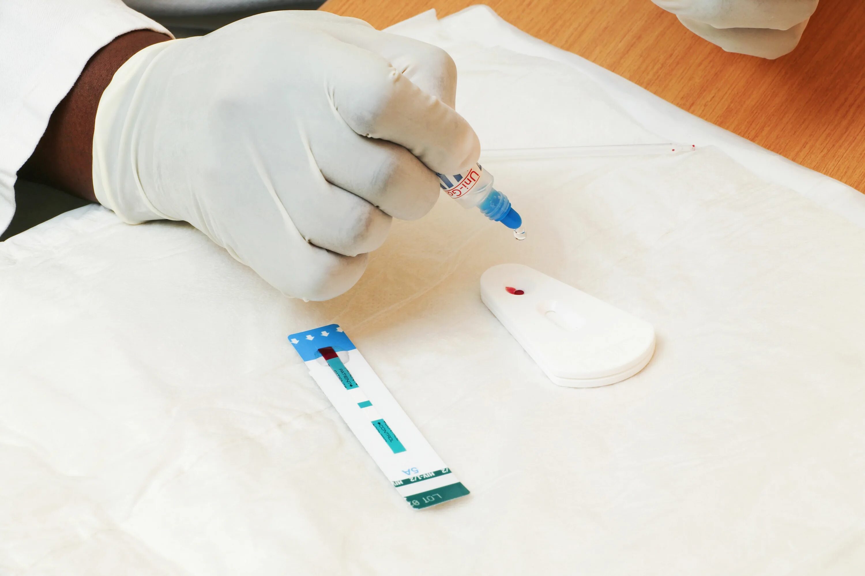 Тест на вич по крови. HIV Testi на ВИЧ. Экспресс тест на ВИЧ кровь. Отрицательный тест на ВИЧ. Экспресс тест на ВИЧ отрицательный.