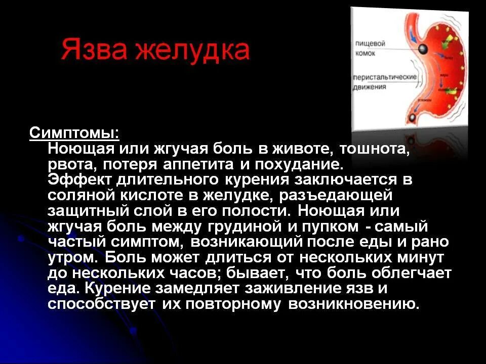 Языка желудкасимптомы. Симптомы язвенной болезни. Как проверить язву