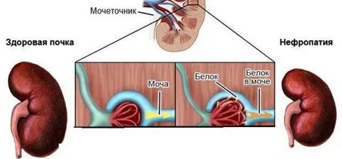 Почечный белок