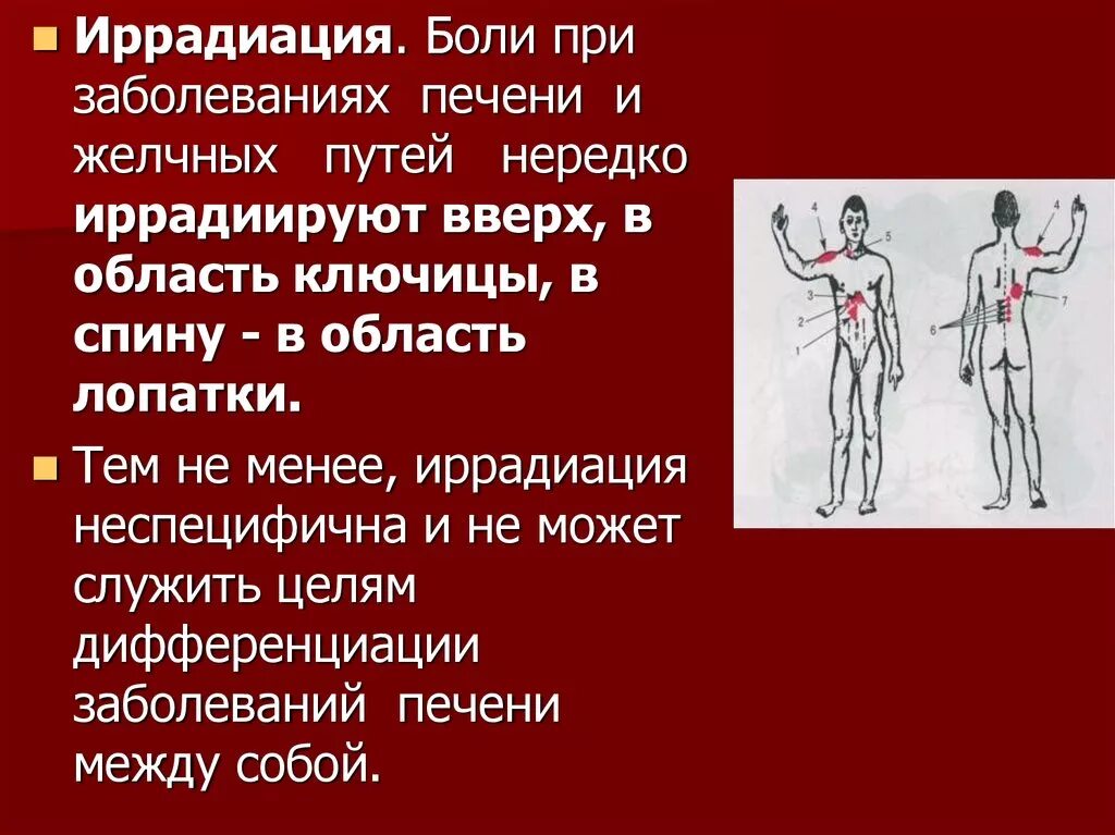 Боли при заболевании печени. Боль при желчном иррадиации. Локализация и иррадиация боли. Иррадиация боли при заболевании печени. Иррадиация боли при патологии желчного пузыря.