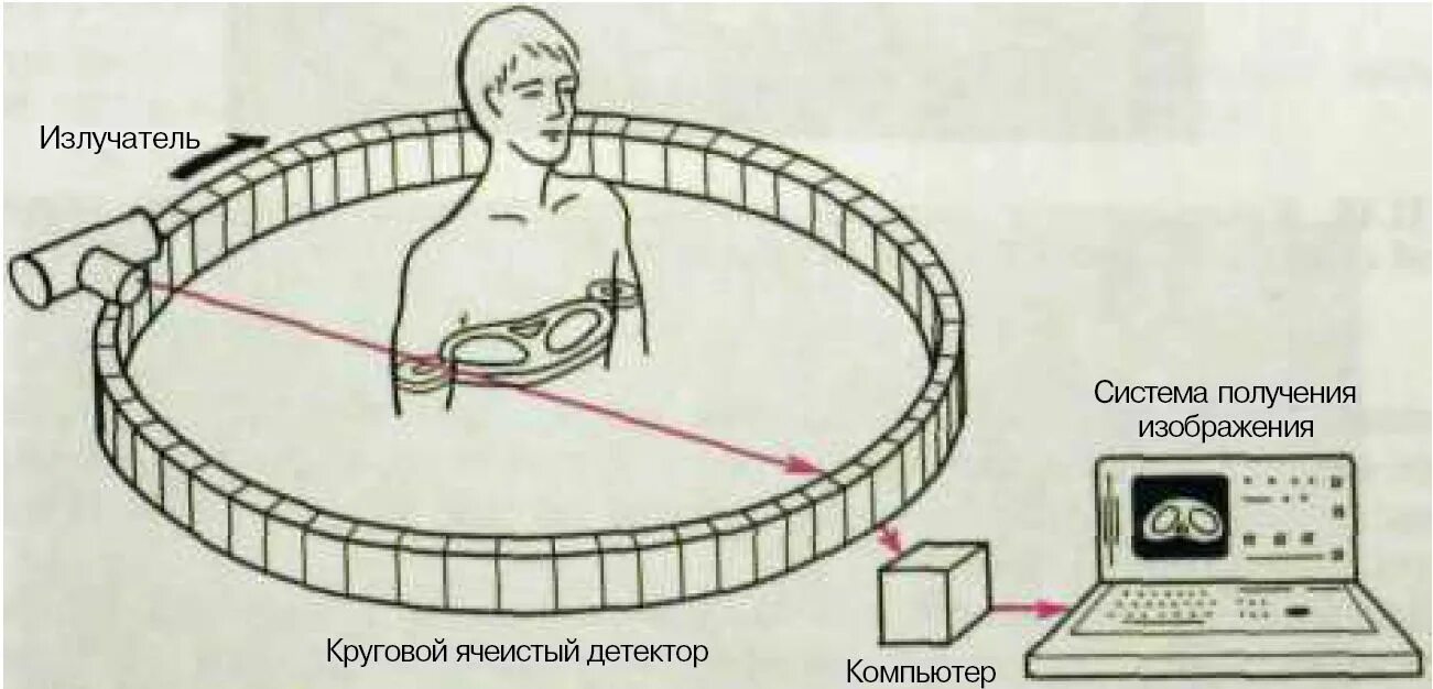 Работа компьютерного томографа. Схема строения компьютерного томографа. компьютерная томография принцип работы. принцип работы кт томографа. компьютерная томография принцип работы компьютерного томографа.