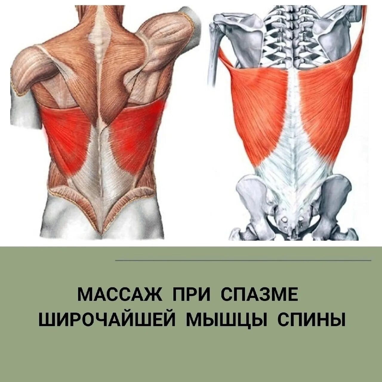 Классификация и строение мышц. Подёргивание мышц по всему телу. Ромбовидная мышца спины триггерные точки. Мышцы разгибатели позвоночника анатомия. Ромбовидные мышцы спины анатомия.