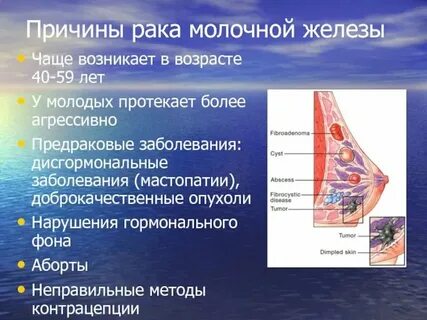 Грудные инфекции