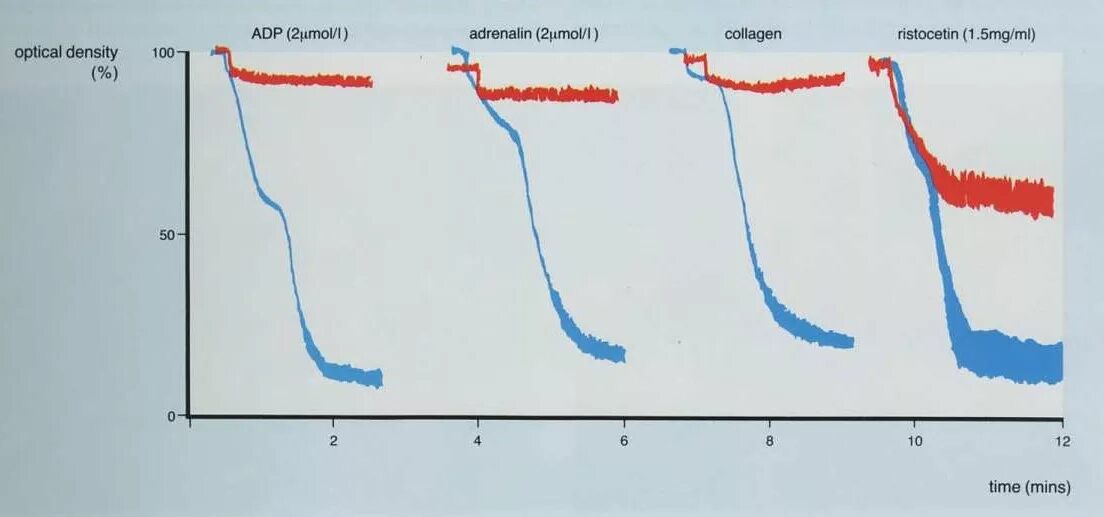 Коллаген агрегация. Агрегатограмма. Расшифровка агрегатограммы. Функция тромбоцитов коллаген эпинефрин. Ристоцетин.