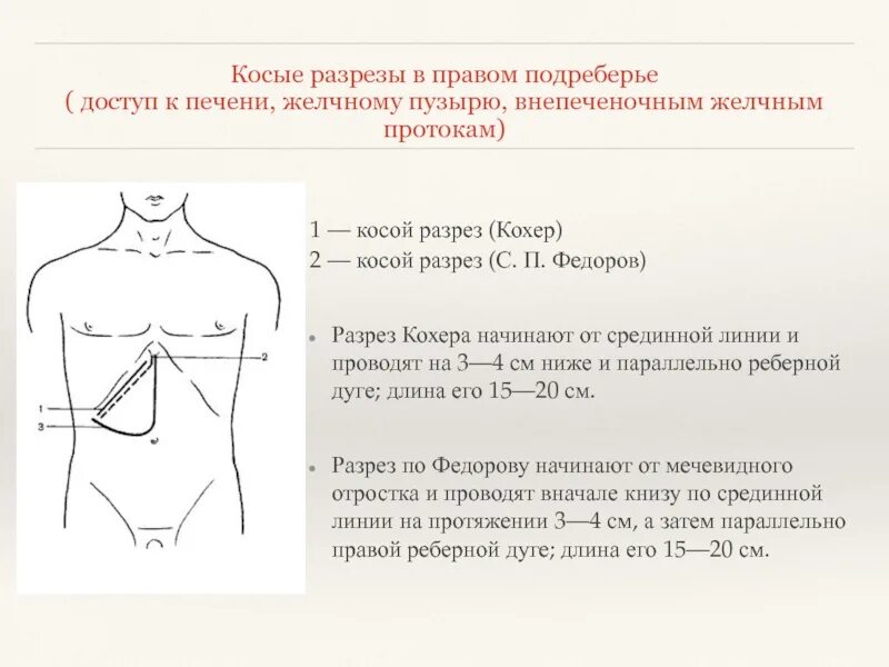 Бандаж после операции желчного пузыря. Бандаж после операции желчного пузыря