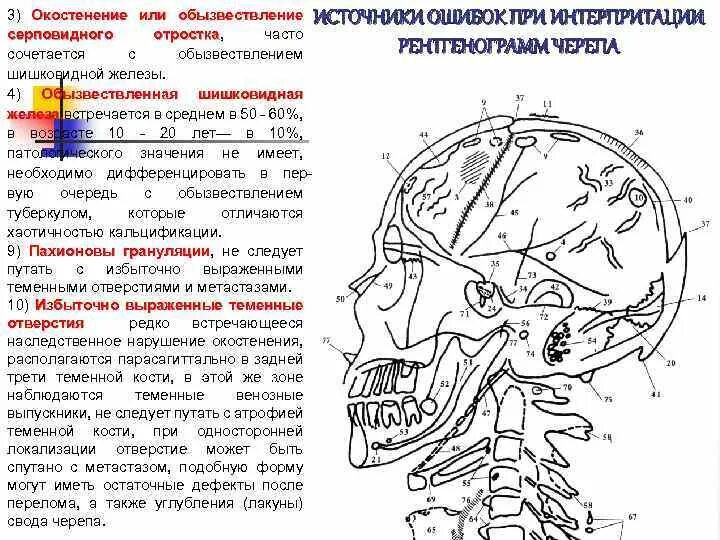 Отросток мозга 4. Обызвествление серповидного отростка на рентгене. Обызвествление серповидного отростка рентген черепа. Обызвествление шишковидной железы. Обызвествление серпа головного мозга.