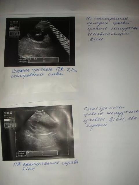 распечатка узи и беременность. узи по беременности воронеж. 3д узи скрининг обнинск. узи по беременности воронеж. 3д узи при беременности аппарат.