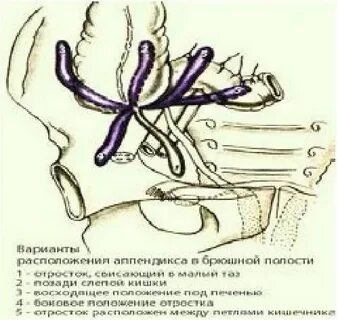 Точки аппендикса