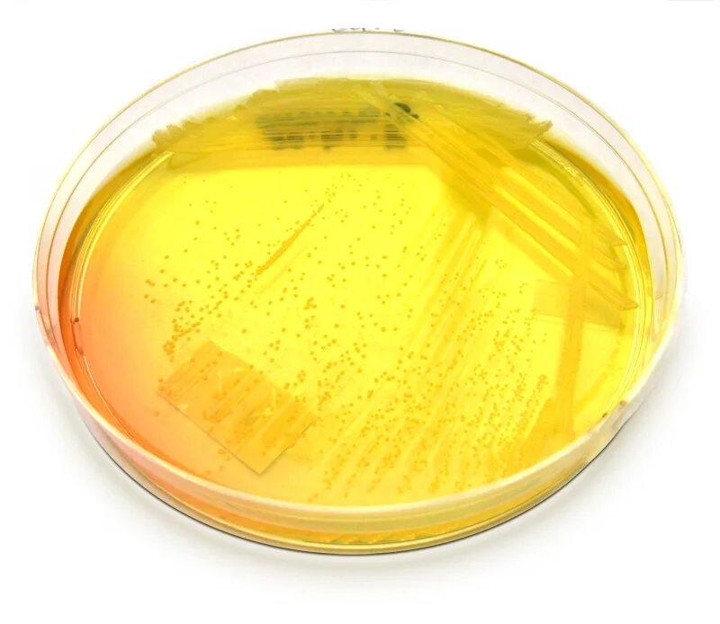 Ба агар. Маннитол солевой агар. Мясопептонный агар. Staphylococcus aureus на желточно-солевом агаре. Желточно-солевой агар питательная основа.